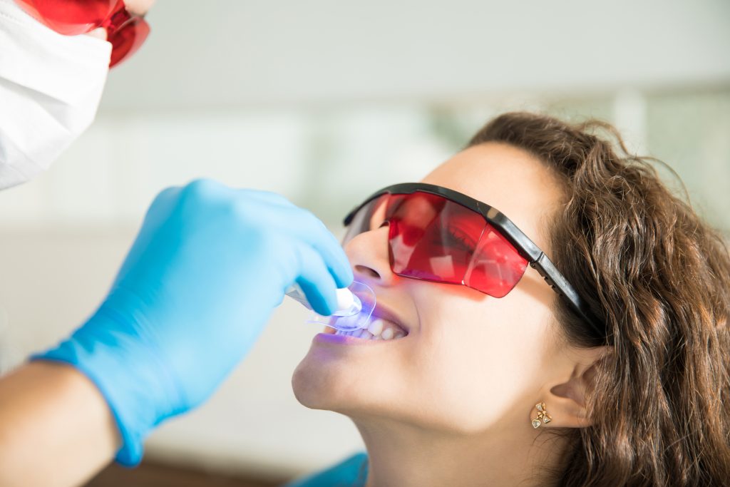 Teeth Scaling & Polishing